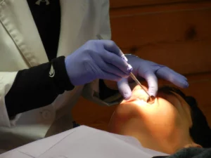 extraction dents de sagesse prix