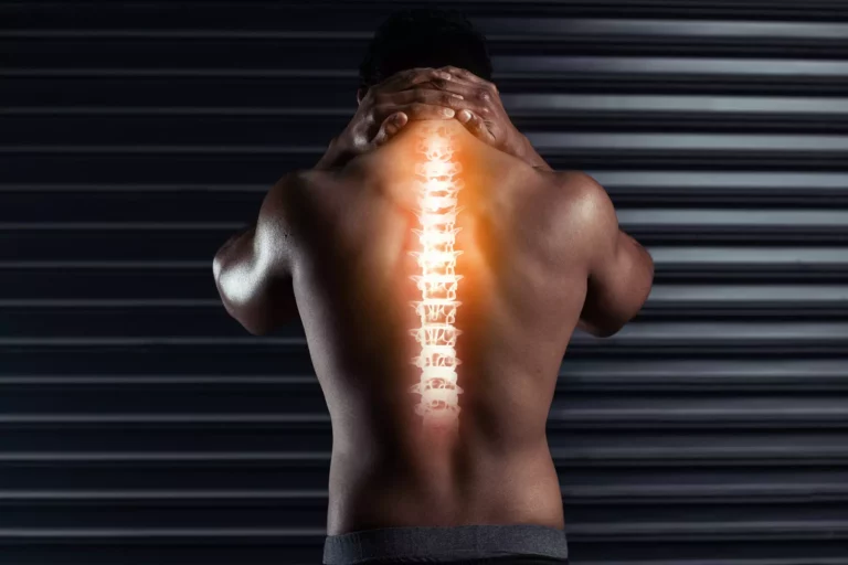 Arthrodèse lombaire : la clé du succès